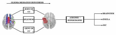 Glioma Migration Through the Corpus Callosum and the Brainstem Detected by Diffusion and Magnetic Resonance Imaging: Initial Findings